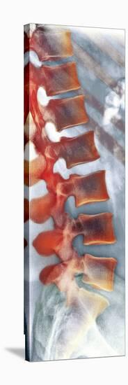 Healthy Lower Spine, X-ray-Science Photo Library-Stretched Canvas