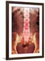 Healthy Lower Spine, X-ray-Du Cane Medical-Framed Photographic Print