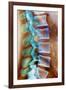 Healthy Lower Spine, X-ray-Science Photo Library-Framed Photographic Print