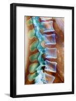 Healthy Lower Spine, X-ray-Science Photo Library-Framed Photographic Print