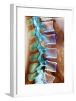 Healthy Lower Spine, X-ray-Science Photo Library-Framed Photographic Print