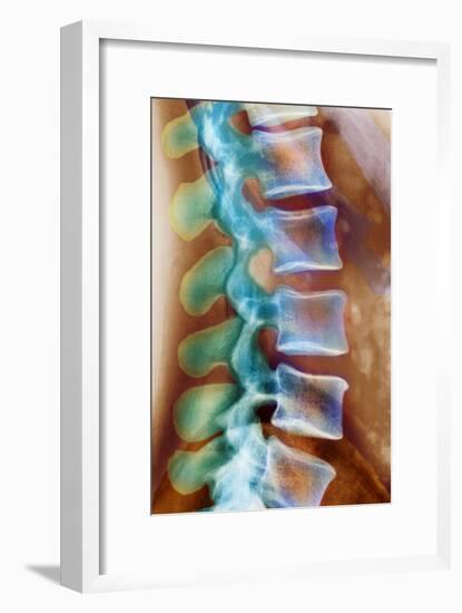 Healthy Lower Spine, X-ray-Science Photo Library-Framed Photographic Print