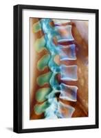 Healthy Lower Spine, X-ray-Science Photo Library-Framed Photographic Print
