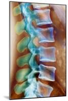 Healthy Lower Spine, X-ray-Science Photo Library-Mounted Photographic Print