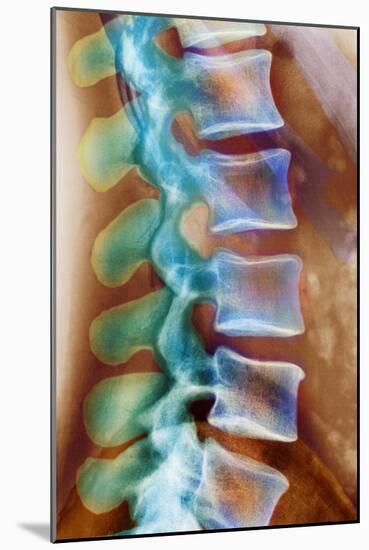 Healthy Lower Spine, X-ray-Science Photo Library-Mounted Photographic Print