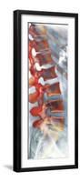 Healthy Lower Spine, X-ray-Science Photo Library-Framed Photographic Print