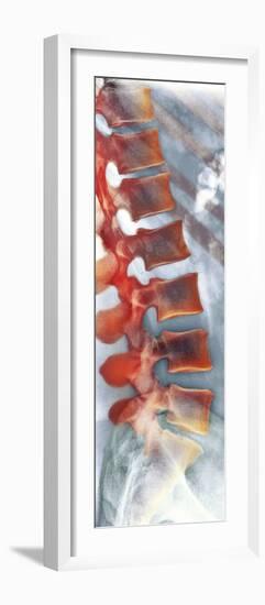 Healthy Lower Spine, X-ray-Science Photo Library-Framed Photographic Print