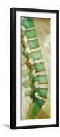 Healthy Lower Spine, X-ray-Science Photo Library-Framed Photographic Print