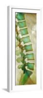 Healthy Lower Spine, X-ray-Science Photo Library-Framed Photographic Print