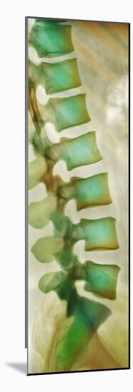 Healthy Lower Spine, X-ray-Science Photo Library-Mounted Photographic Print