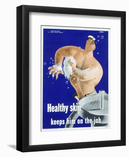 Healthy Skin Keeps Him on the Job-null-Framed Premium Giclee Print