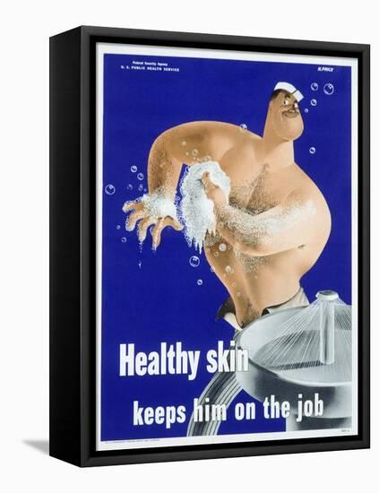 Healthy Skin Keeps Him on the Job-null-Framed Stretched Canvas