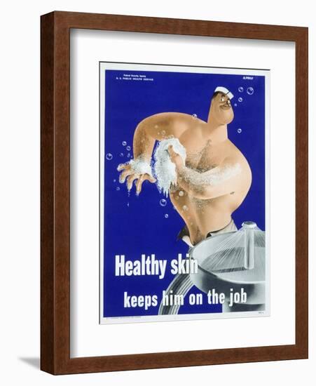 Healthy Skin Keeps Him on the Job-null-Framed Giclee Print