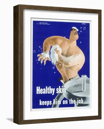 Healthy Skin Keeps Him on the Job-null-Framed Giclee Print