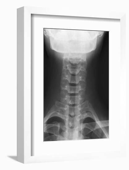 Healthy Spine of the Neck, X-ray'-Du Cane Medical-Framed Photographic Print