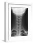 Healthy Spine of the Neck, X-ray'-Du Cane Medical-Framed Photographic Print