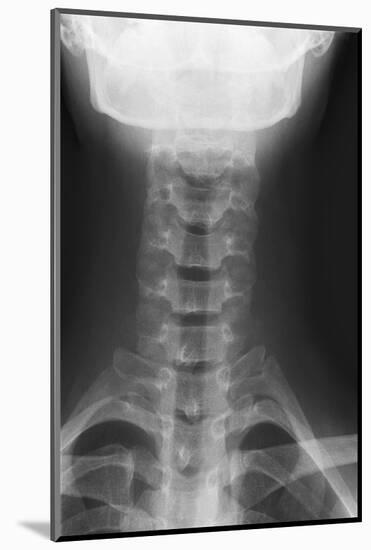 Healthy Spine of the Neck, X-ray'-Du Cane Medical-Mounted Photographic Print