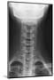 Healthy Spine of the Neck, X-ray'-Du Cane Medical-Mounted Photographic Print