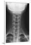 Healthy Spine of the Neck, X-ray'-Du Cane Medical-Framed Photographic Print