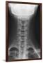 Healthy Spine of the Neck, X-ray'-Du Cane Medical-Framed Photographic Print