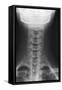 Healthy Spine of the Neck, X-ray'-Du Cane Medical-Framed Stretched Canvas