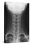 Healthy Spine of the Neck, X-ray'-Du Cane Medical-Stretched Canvas