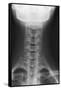 Healthy Spine of the Neck, X-ray'-Du Cane Medical-Framed Stretched Canvas