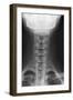 Healthy Spine of the Neck, X-ray'-Du Cane Medical-Framed Photographic Print