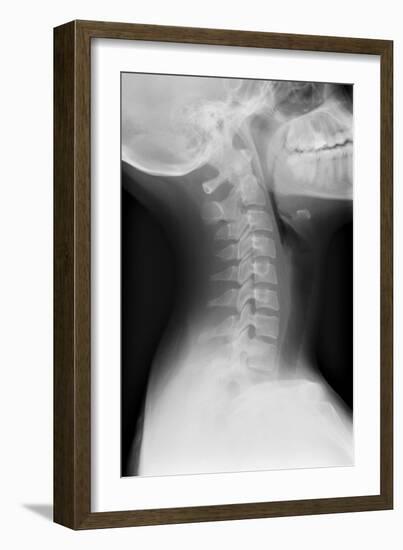 Healthy Spine of the Neck, X-ray'-Du Cane Medical-Framed Photographic Print