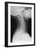 Healthy Spine of the Neck, X-ray'-Du Cane Medical-Framed Photographic Print