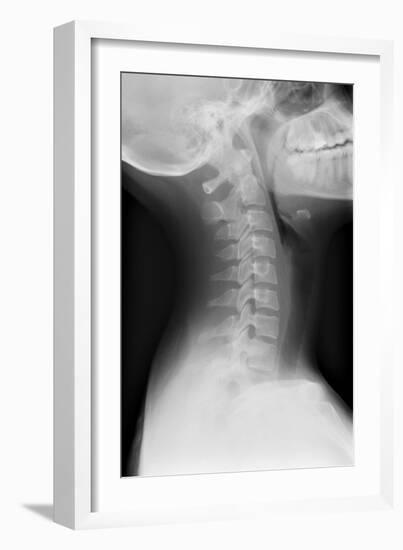 Healthy Spine of the Neck, X-ray'-Du Cane Medical-Framed Photographic Print