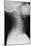 Healthy Spine of the Neck, X-ray'-Du Cane Medical-Mounted Photographic Print