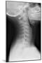 Healthy Spine of the Neck, X-ray'-Du Cane Medical-Mounted Photographic Print