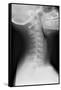 Healthy Spine of the Neck, X-ray'-Du Cane Medical-Framed Stretched Canvas
