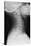 Healthy Spine of the Neck, X-ray'-Du Cane Medical-Stretched Canvas