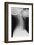 Healthy Spine of the Neck, X-ray'-Du Cane Medical-Framed Photographic Print