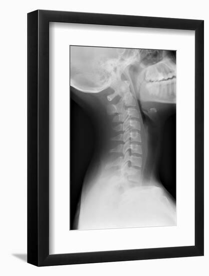 Healthy Spine of the Neck, X-ray'-Du Cane Medical-Framed Photographic Print