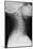 Healthy Spine of the Neck, X-ray'-Du Cane Medical-Mounted Photographic Print