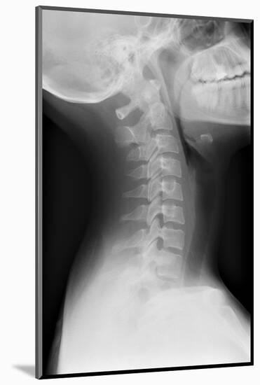 Healthy Spine of the Neck, X-ray'-Du Cane Medical-Mounted Photographic Print
