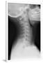 Healthy Spine of the Neck, X-ray'-Du Cane Medical-Framed Photographic Print