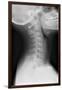 Healthy Spine of the Neck, X-ray'-Du Cane Medical-Framed Photographic Print