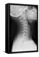 Healthy Spine of the Neck, X-ray'-Du Cane Medical-Framed Stretched Canvas