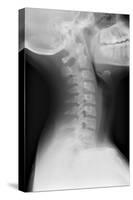 Healthy Spine of the Neck, X-ray'-Du Cane Medical-Stretched Canvas