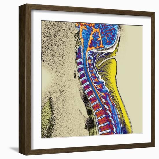 Healthy Spine-Du Cane Medical-Framed Premium Photographic Print