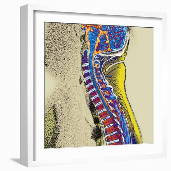 Healthy Spine-Du Cane Medical-Framed Premium Photographic Print