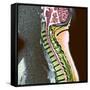 Healthy Spine-Du Cane Medical-Framed Stretched Canvas