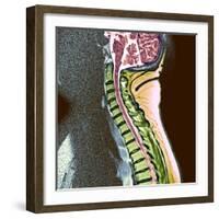 Healthy Spine-Du Cane Medical-Framed Premium Photographic Print