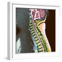 Healthy Spine-Du Cane Medical-Framed Premium Photographic Print