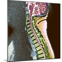 Healthy Spine-Du Cane Medical-Mounted Premium Photographic Print