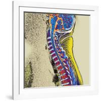 Healthy Spine-Du Cane Medical-Framed Photographic Print